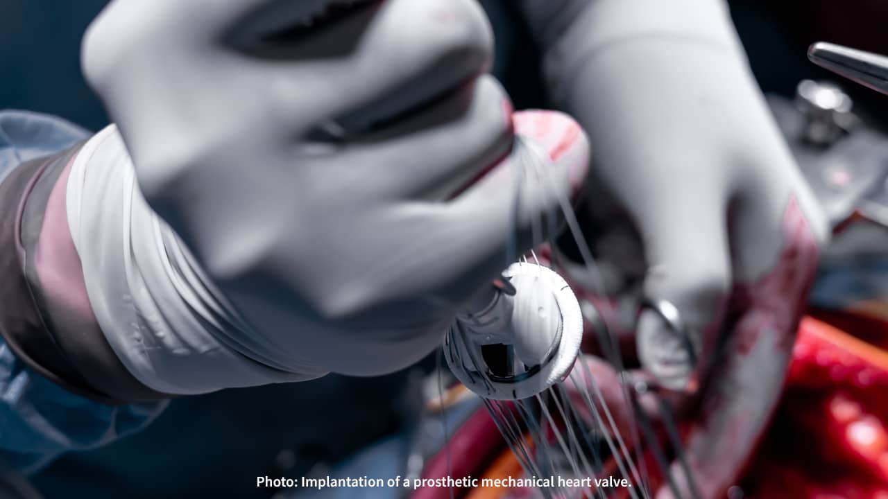 Which Plastics are Biocompatible?